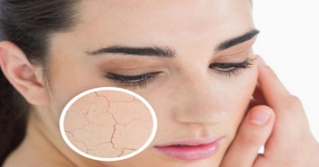 Cilt Kuruluğuna Ne İyi Gelir?