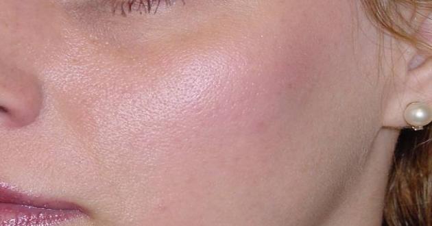 Gözenek Sıkılaştırıcı Doğal Tonik Tarifleri