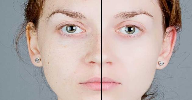 Hücre Ve Cilt Yenileyici Maske Tarifleri