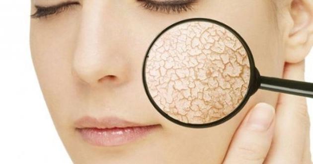 Kuru Cilt için Maske Tarifleri