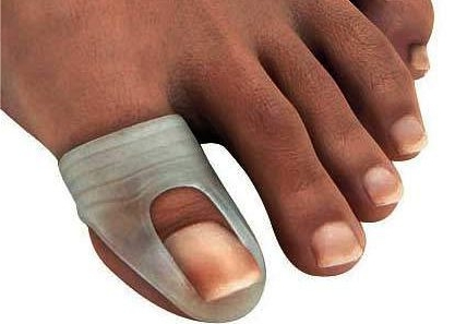 Tırnak Batması Neden Olur? Tırnak Batması Nasıl Geçer?