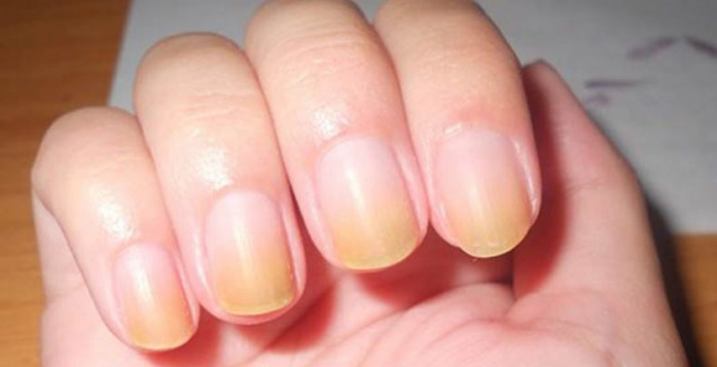 Ojeden Sonra Tırnaklar Nasıl Beyazlatılır?