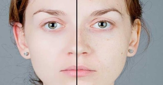 Cilt Yenileyen Maske Tarifleri