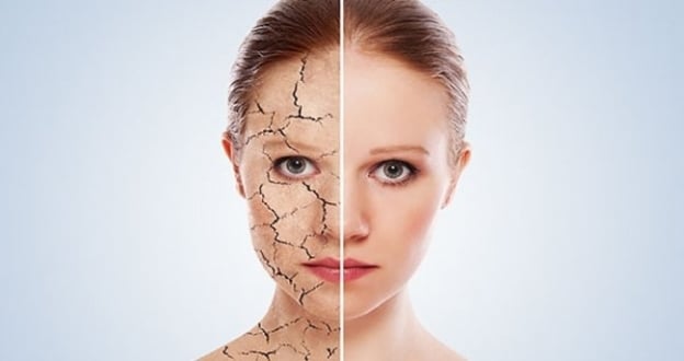 Cilt Kuruluğuna Ne İyi Gelir? En Etkili Ev Yapımı Maske Tarifleri