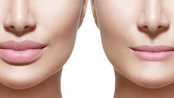 Dudak Dolgusu Nasıl Yapılır