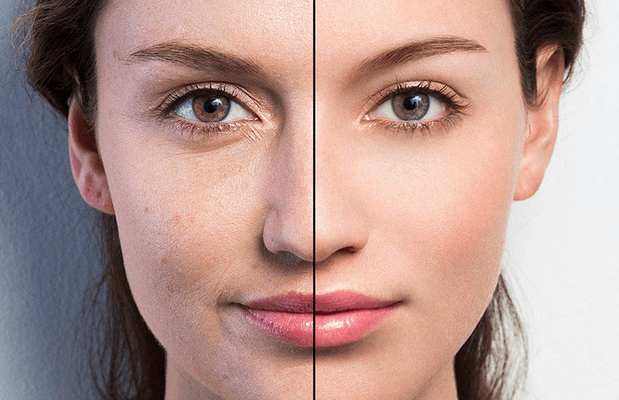 Cam Gibi Bir Cilt İçin Maya Maskesi Tarifleri