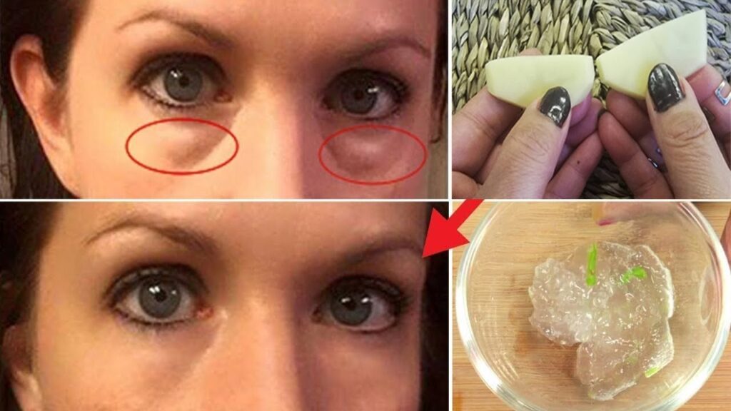 Göz Altı Torbalarını Gidermek İçin Maske Tarifleri