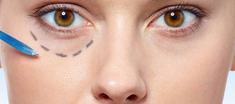 Göz Altı Işık Dolgusu Nedir? Ne İşe Yarar?