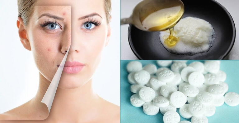 Cildi Gençleştiren Aspirin Maskesi Nasıl Yapılır Faydaları Nelerdir?